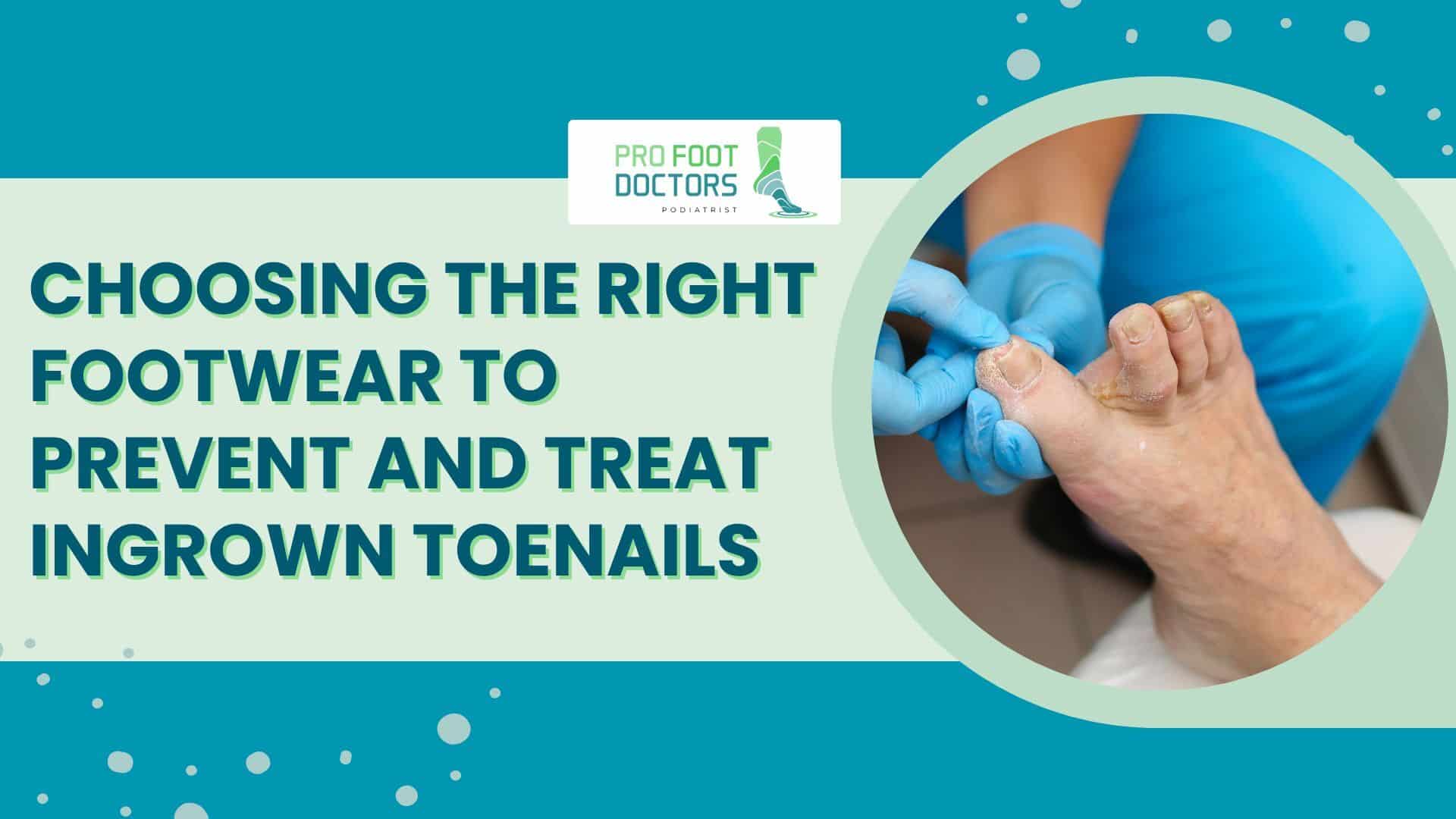 Choose Right Footwear to Prevent and Treat Ingrown Toenails