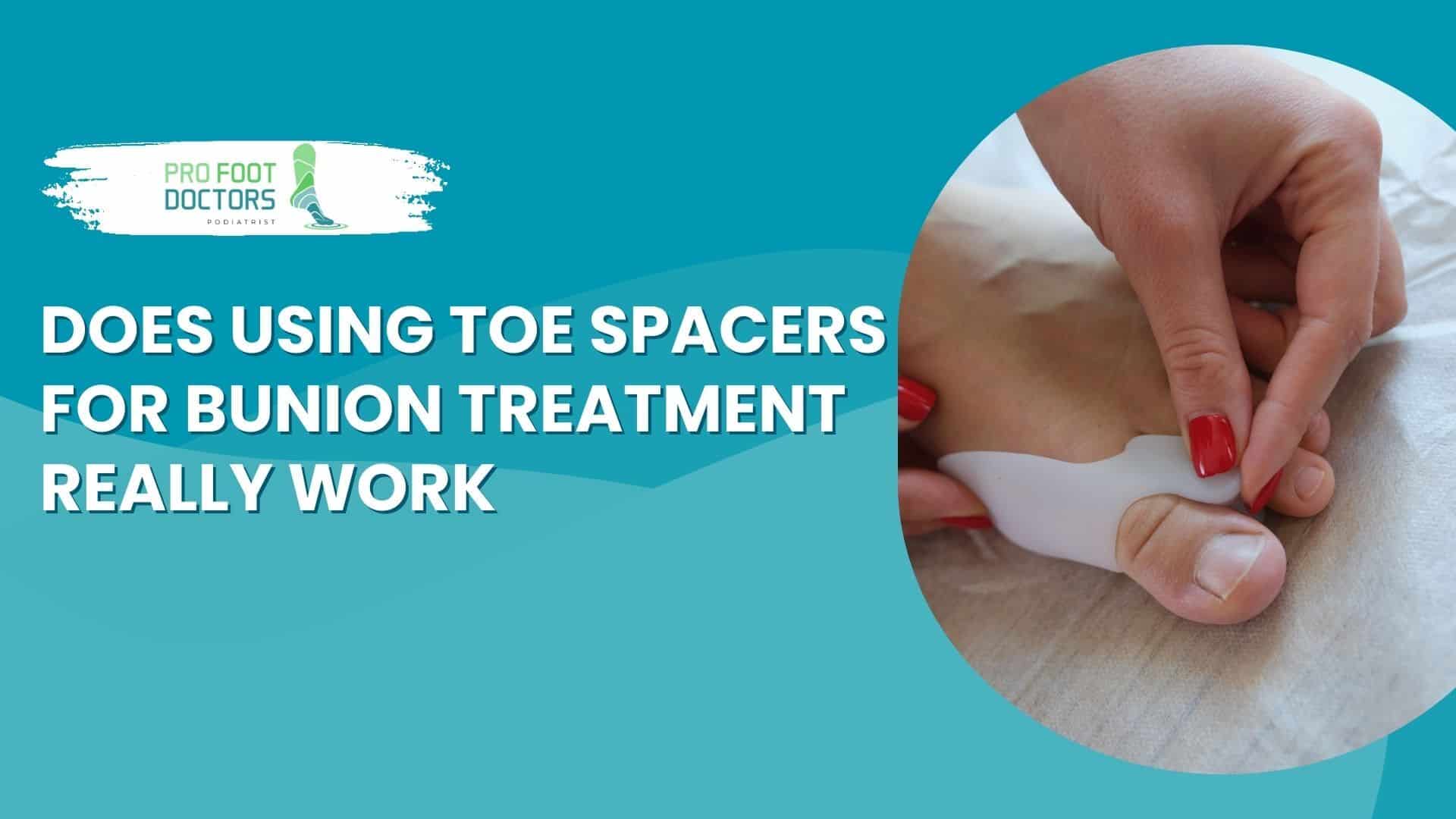 Does Using Toe Spacers for Bunion Treatment Really Work?