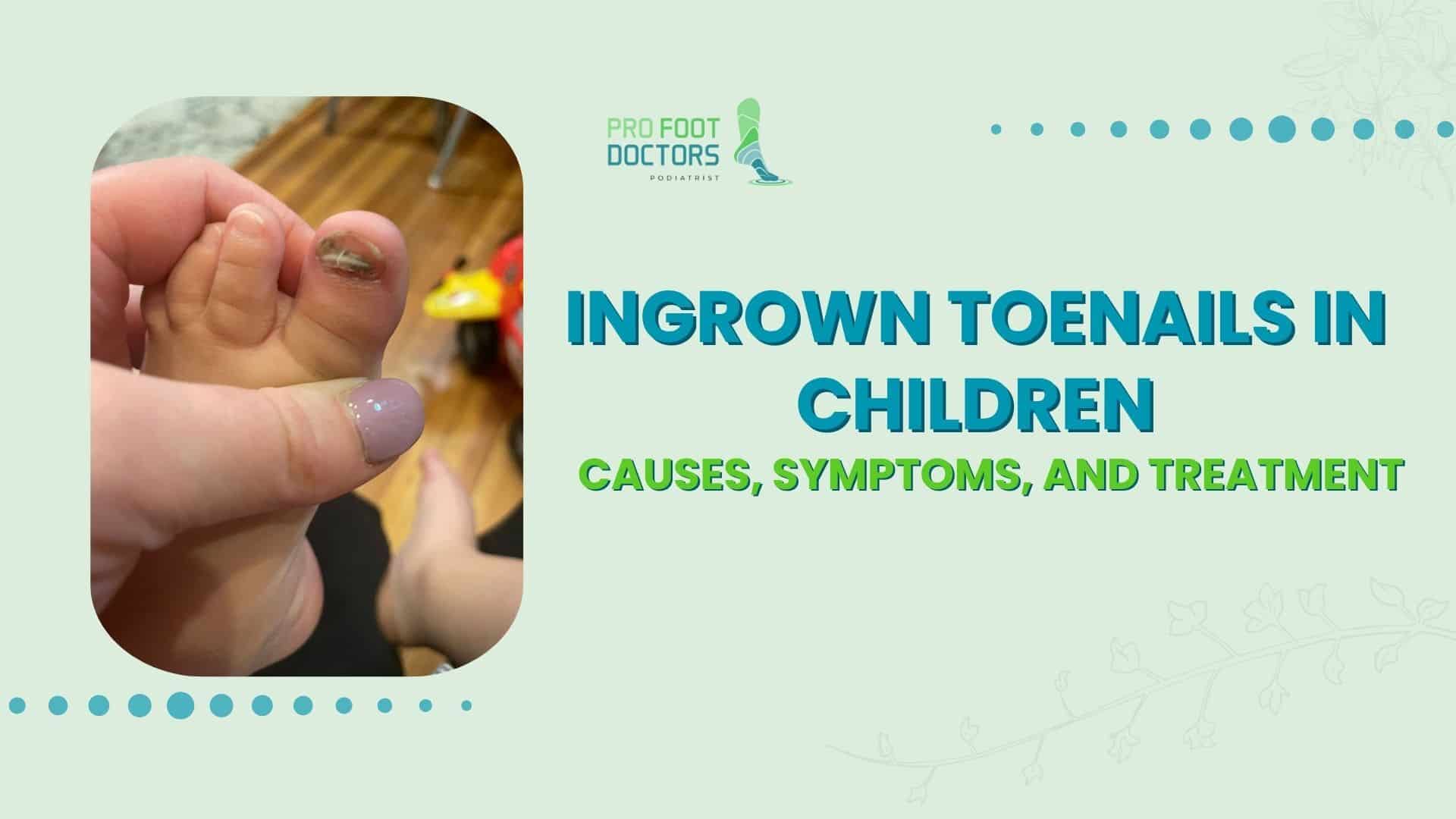 Ingrown Toenails in Children: Causes, Symptoms, and Treatment