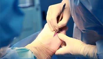 Nerve Surgery