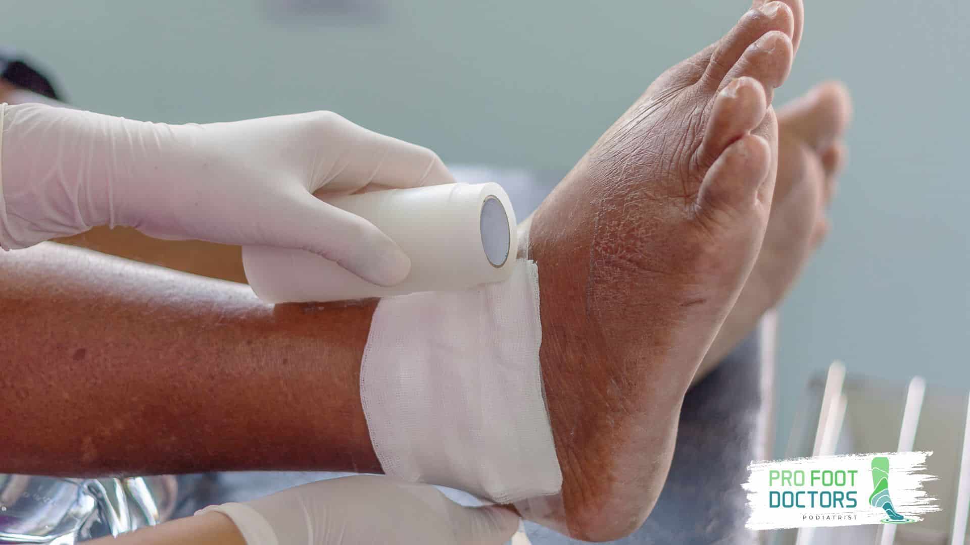 Should I see a Doctor after Spraining My Ankle? - Pro Foot Doctors