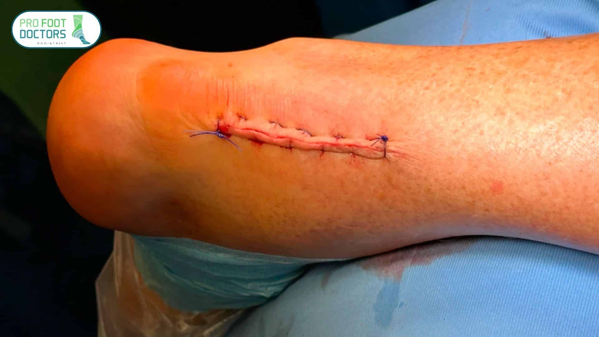 Surgical Treatment