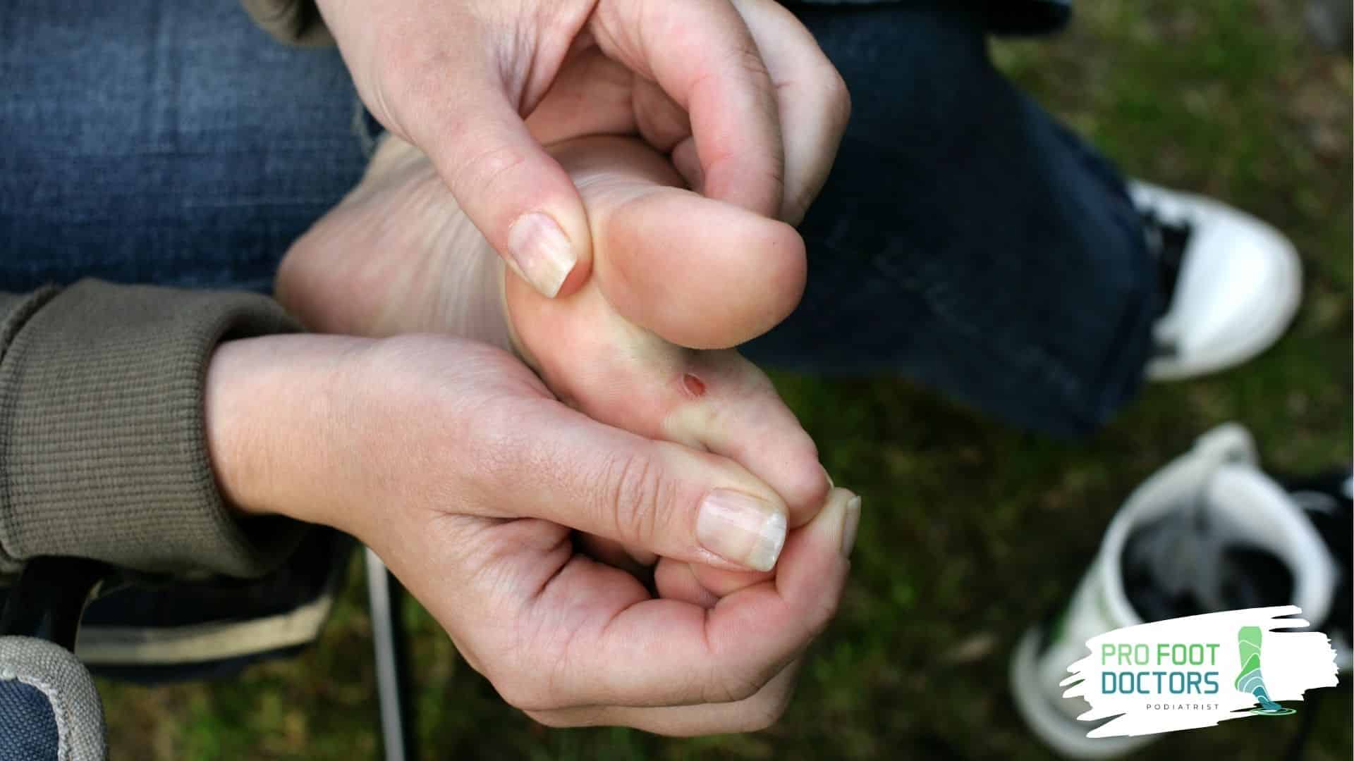 The Unique Nature of Diabetic Foot Infections