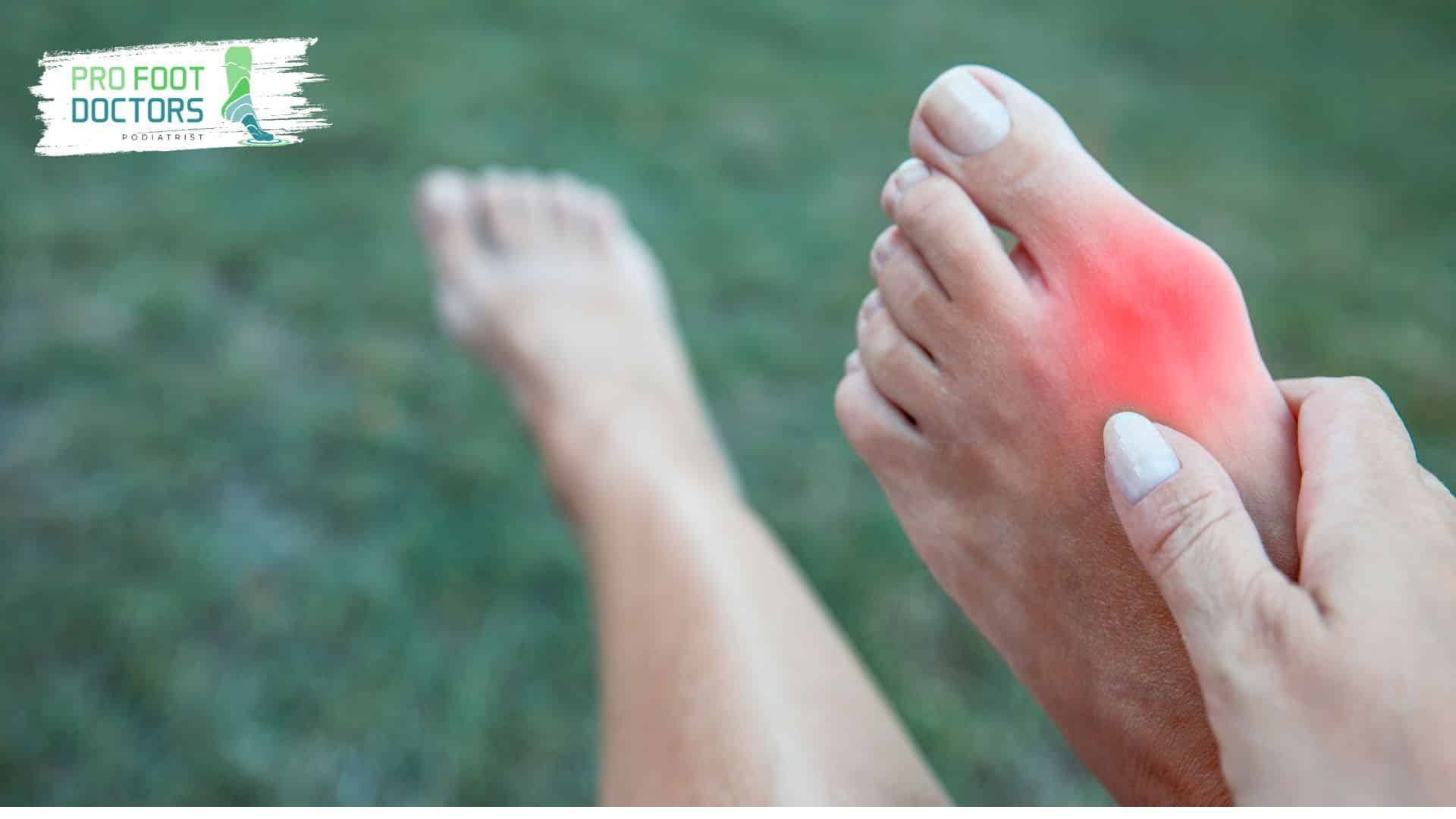What Is Minimally Invasive Bunion Surgery?