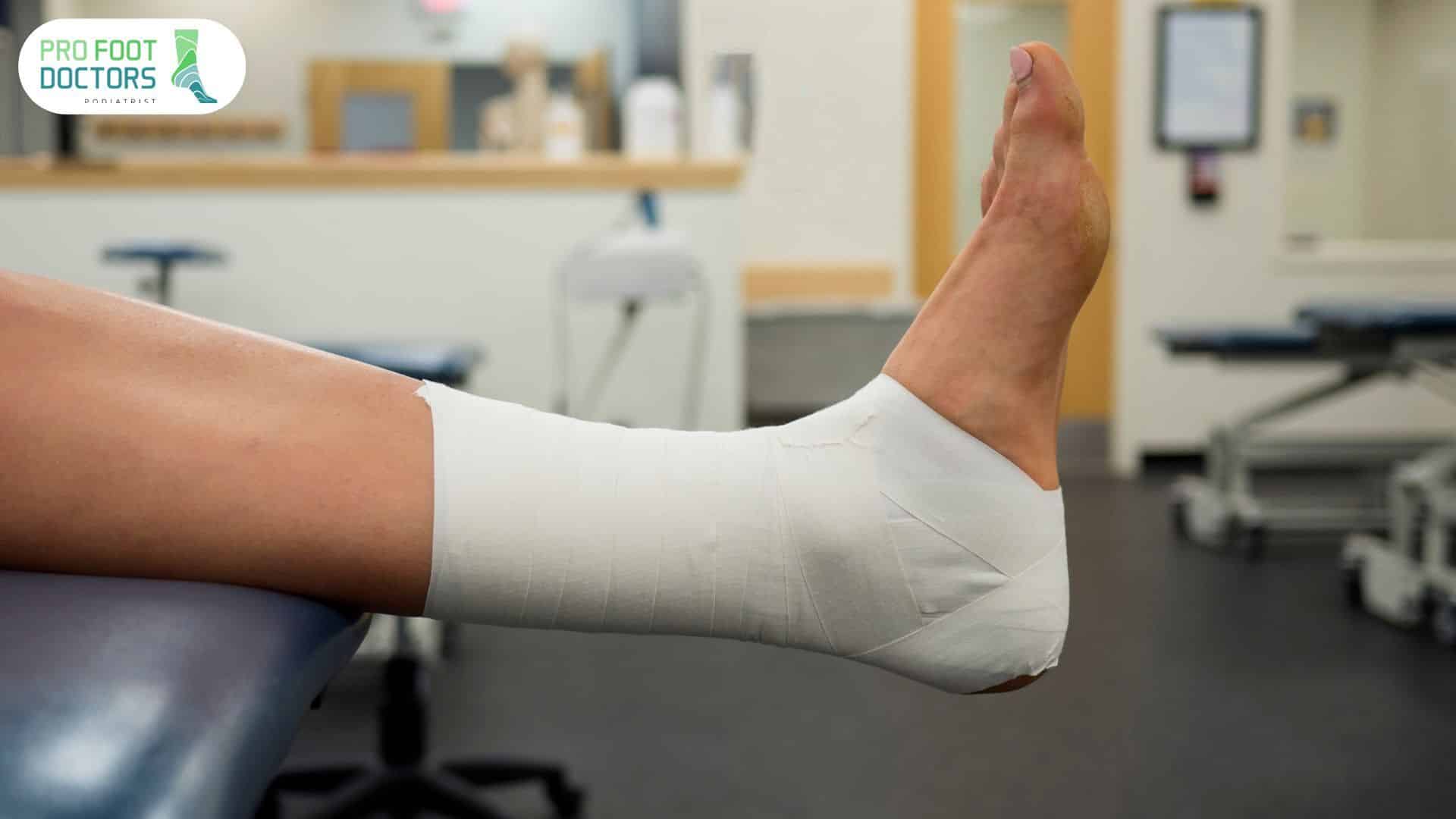 What are Ankle Tapes