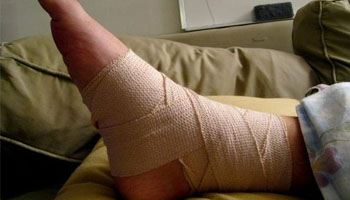 Ankle Injuries - Sprain And Fractures