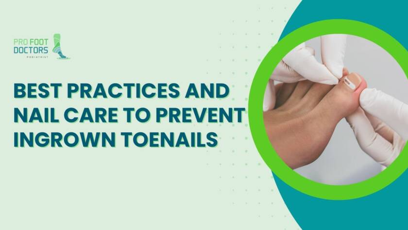 Best Practices and Nail Care to Prevent Ingrown Toenails