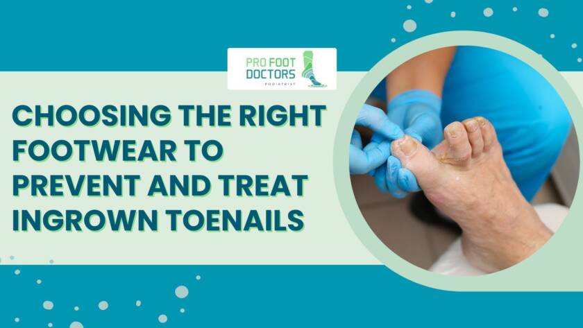 Choosing the Right Footwear to Prevent and Treat Ingrown Toenails