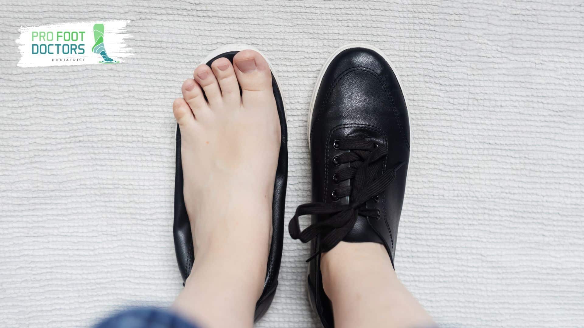 Proper footwear to avoid ingrown toenails - Pro Foot Doctors