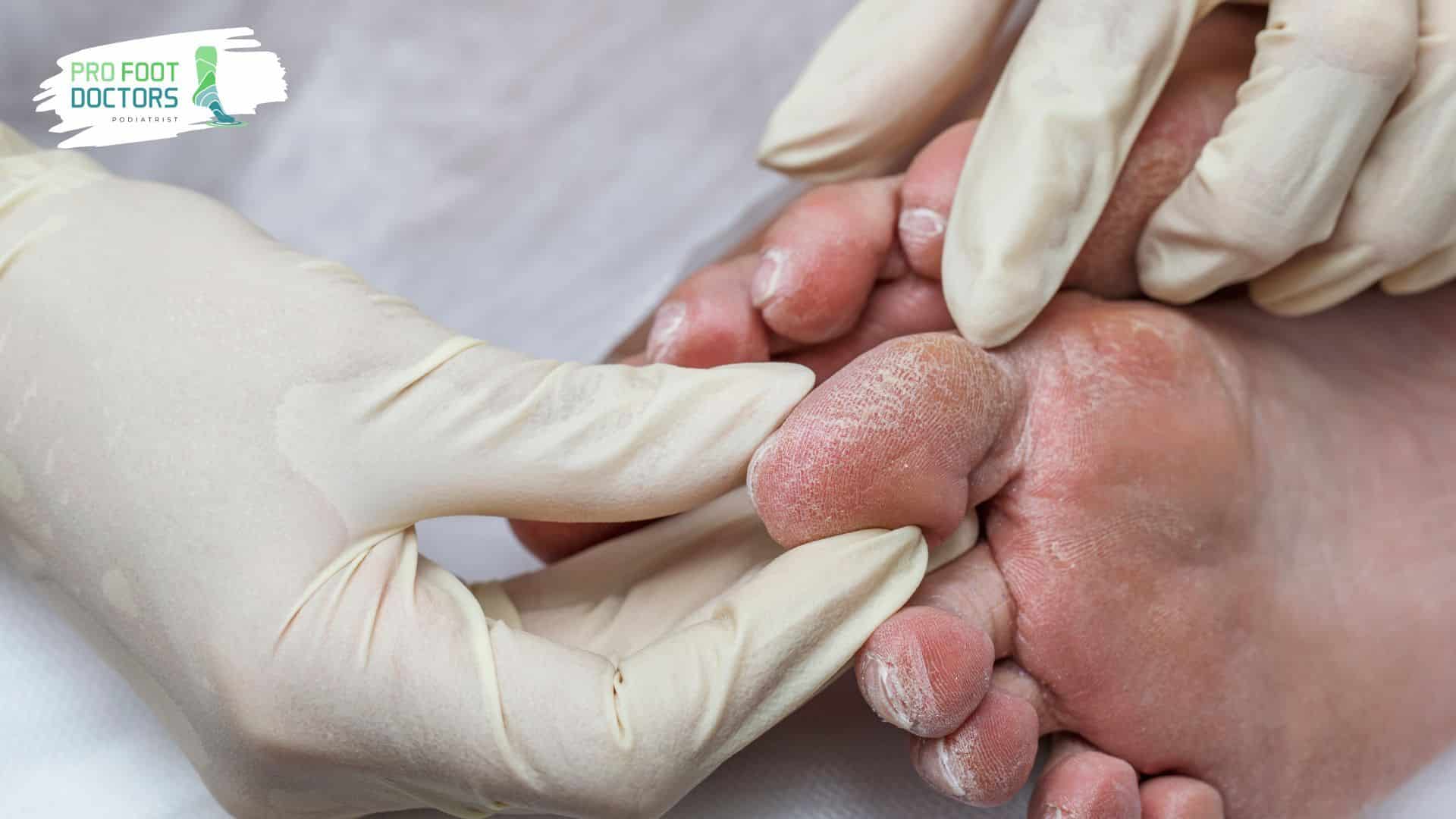A Case for Professional Help - Pro Foot Doctors