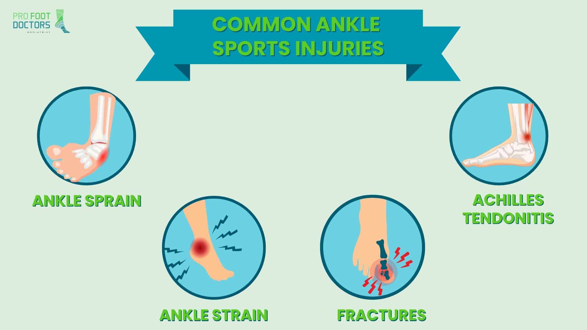 Common Ankle Sports Injuries