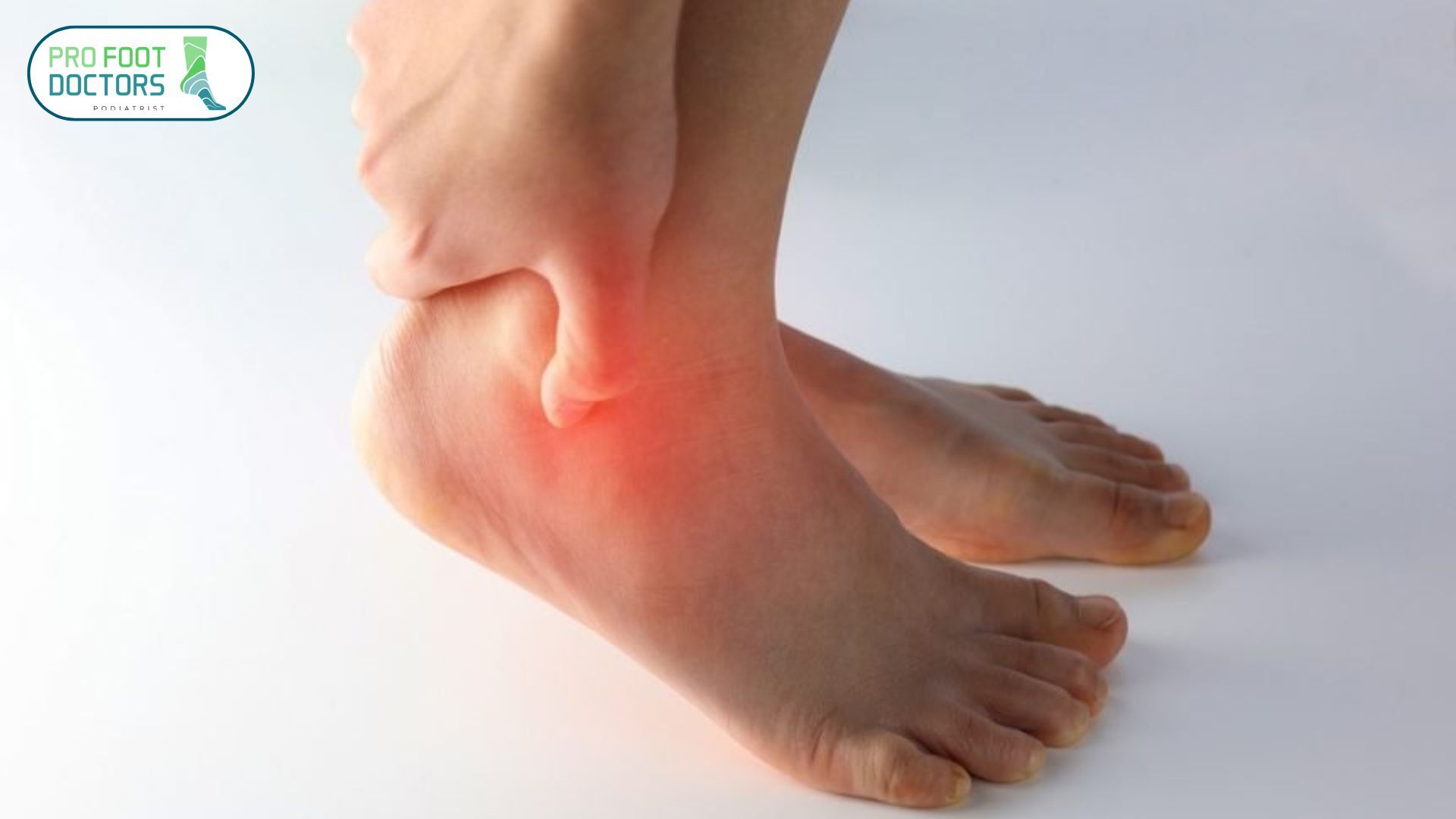 What Is a High Ankle Sprain