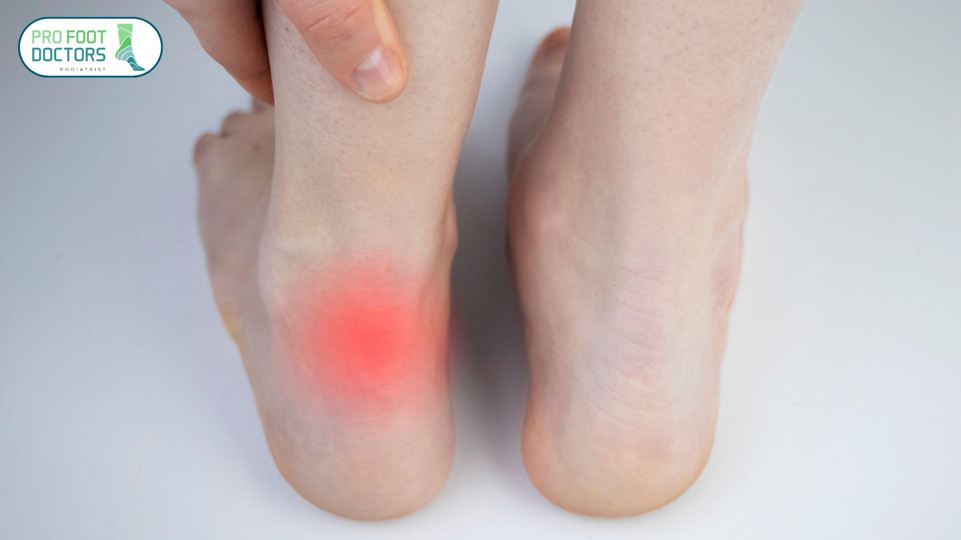 Signs of an Achilles Tendon Rupture