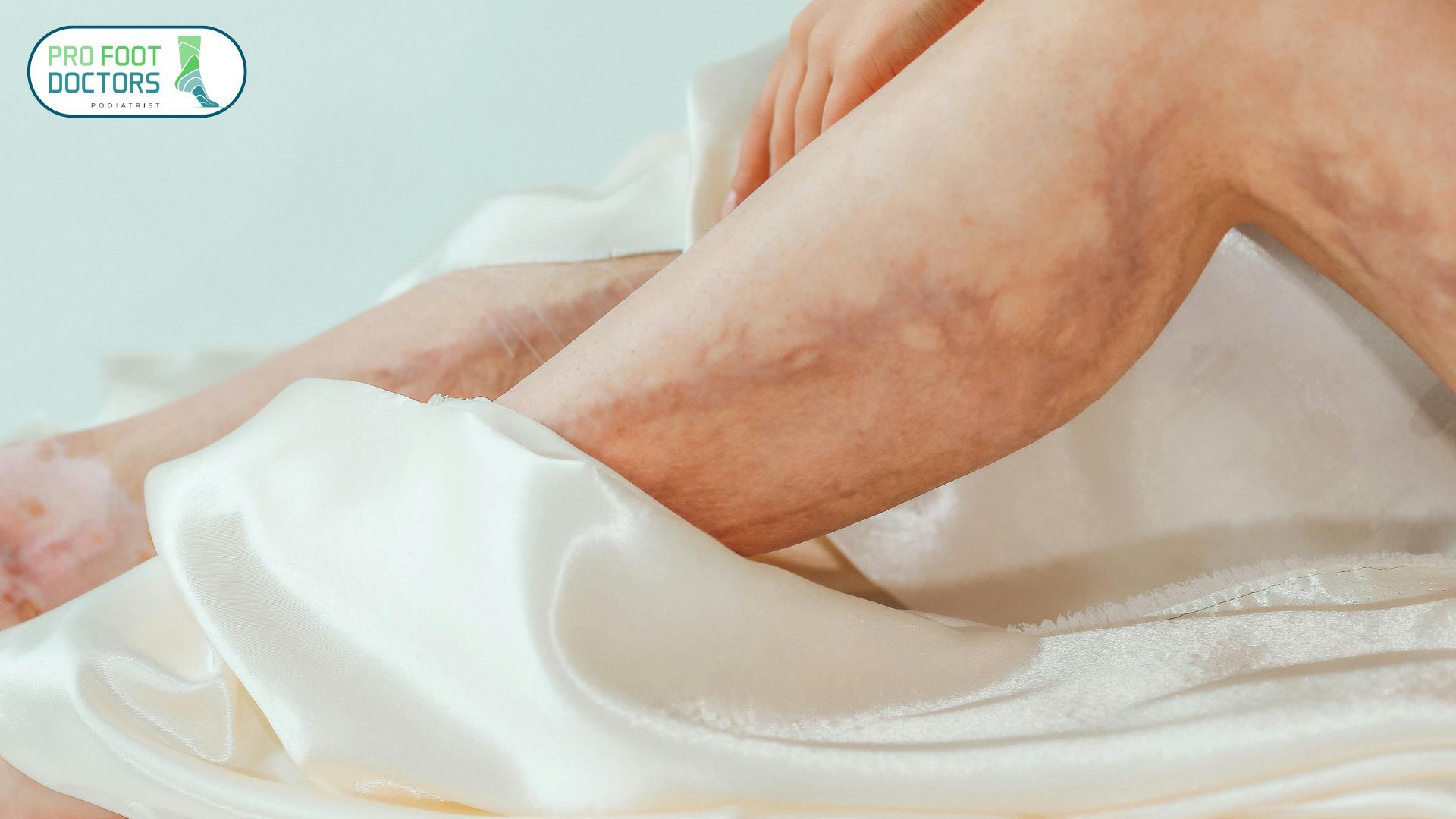 bruising may appear around the heel or calf
