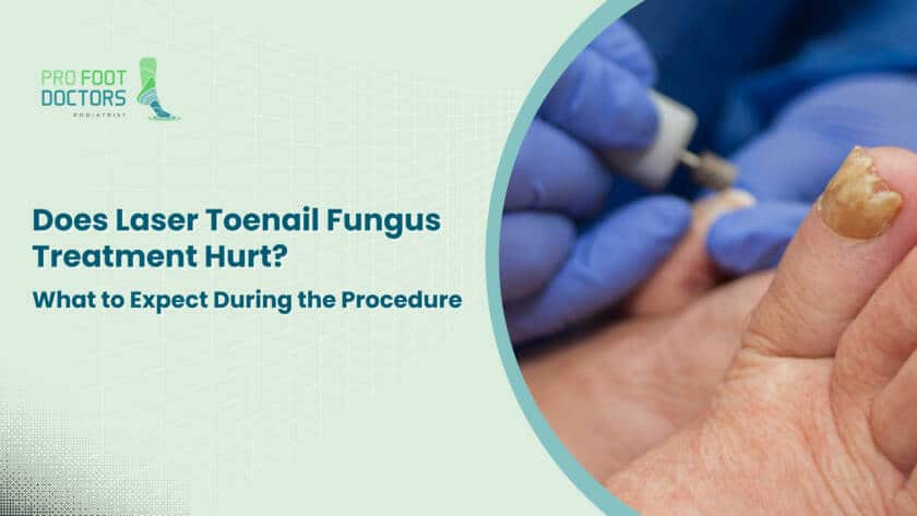 Does Laser Toenail Fungus Treatment Hurt What to Expect During the Procedure