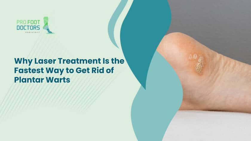Why Laser Treatment Is the Fastest Way to Get Rid of Plantar Warts