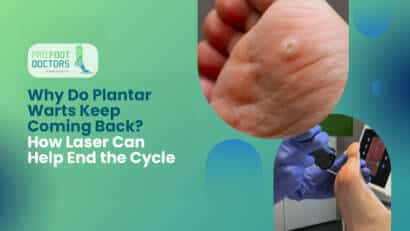 Do Plantar Warts Keep Coming Back How Laser Can Help End the Cycle