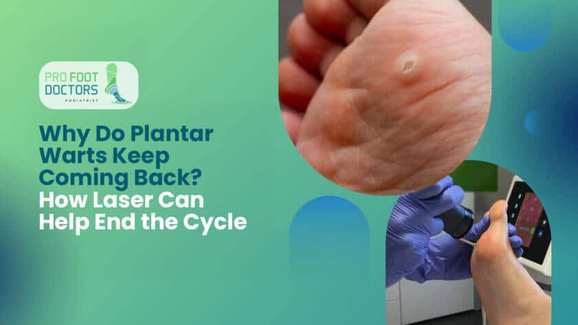 Do Plantar Warts Keep Coming Back How Laser Can Help End the Cycle