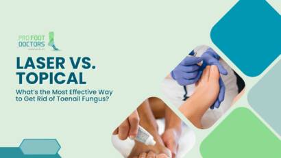 Laser vs Topical What’s the Most Effective Way to Get Rid of Toenail Fungus