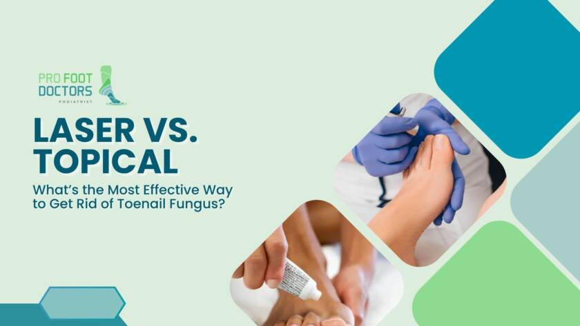 Laser vs Topical What’s the Most Effective Way to Get Rid of Toenail Fungus