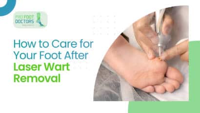 How to Care for Your Foot After Laser Wart Removal
