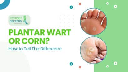 Plantar Wart or Corn Here’s How to Tell and Why It Matters for Treatment