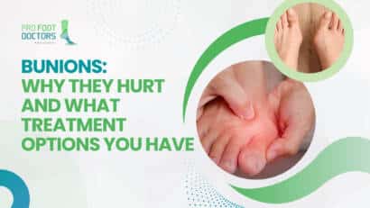 Bunions - Why They Hurt and What Treatment Options You Have