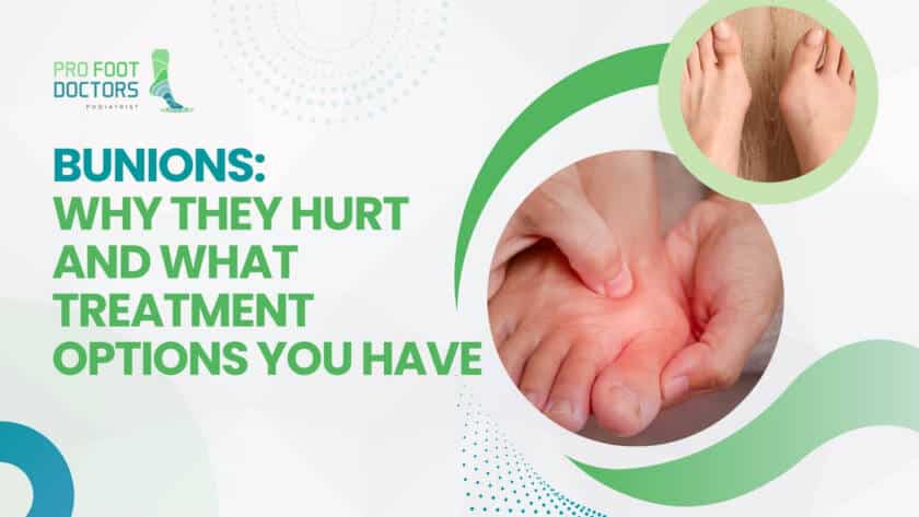 Bunions - Why They Hurt and What Treatment Options You Have