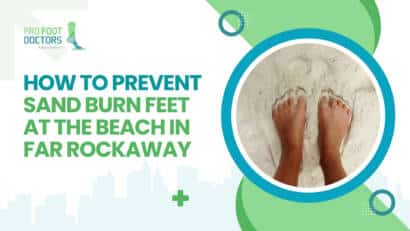 How to Prevent Sand Burn Feet at the Beach in Far Rockaway?
