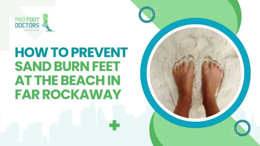 How to Prevent Sand Burn Feet at the Beach in Far Rockaway?